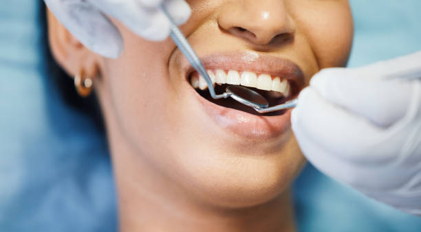 Best Emergency Dentist for Knocked-Out Tooth in Chapin, SC