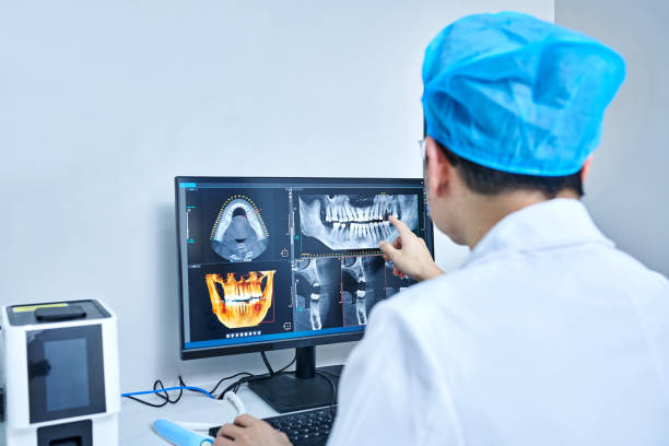 Best Emergency Root Canal Treatment in Chapin, SC